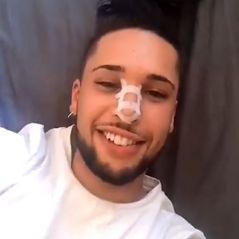 Eddy "très content" de son nouveau nez : après l'opération, il montre le résultat en vidéo