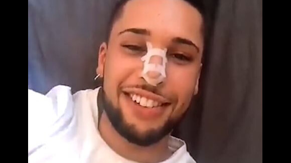 Eddy "très content" de son nouveau nez : après l'opération, il montre le résultat en vidéo