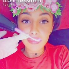 Coralie Porrovecchio : son secret pour des lèvres pulpeuses sans injections