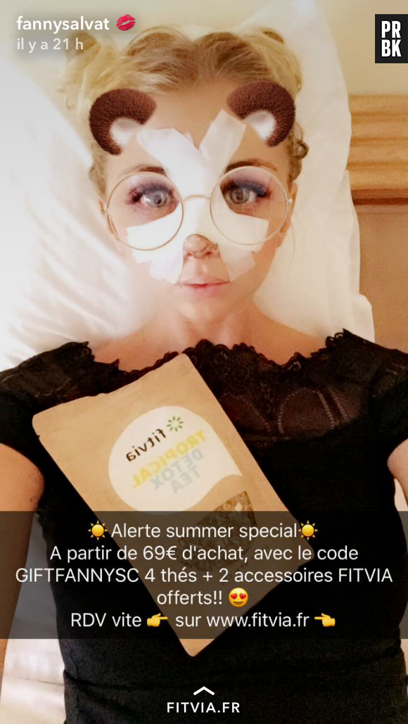 Fanny Salvat (La Villa des Coeurs Brisés 3) : elle a fait refaire son nez !