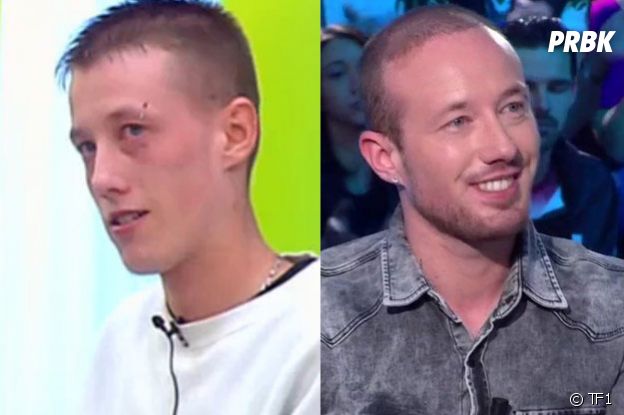 Erwan métamorphosé depuis Secret Story 1