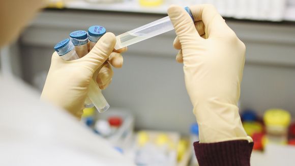 Sida : des chercheurs français relancent l'espoir avec une découverte majeure sur le VIH