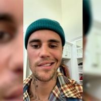 Justin Bieber paralysé du visage : il révèle être atteint d&#039;une maladie neurologique