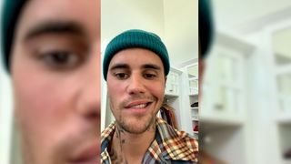 Justin Bieber paralysé du visage : il révèle être atteint d'une maladie neurologique