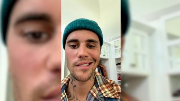 Justin Bieber dévoile être atteint d'une maladie neurologique sur Instagram le vendredi 10 juin 2022
