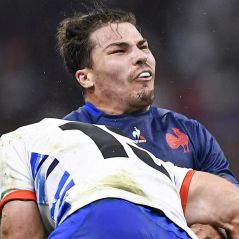 "S'il perd un oeil..." : énorme coup de gueule d'une star du rugby contre Antoine Dupont et la gestion de sa blessure