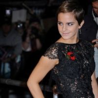 Emma Watson a les ''Boulle'' : trop célèbre pour son ex Francis