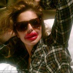 Cheryl Cole et sa nouvelle bouche : très très ''pulpeuse''