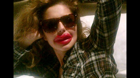 Cheryl Cole et sa nouvelle bouche : très très ''pulpeuse''