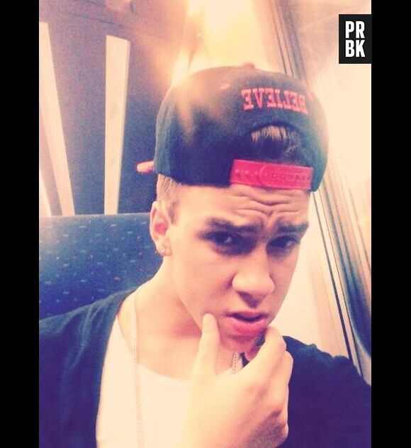 Chris Bieber, le sosie de Justin Bieber, a été victime d'un grave accident de la route jeudi dernier en Belgique.
