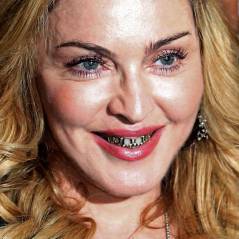 Madonna se prend pour Joey Starr à Rome : grill en or au programme