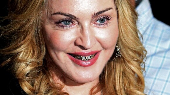 Madonna se prend pour Joey Starr à Rome : grill en or au programme