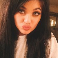 Kylie Jenner Challenge : le "jeu" flippant pour se gonfler les lèvres