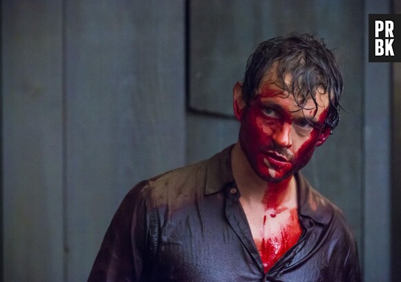 Hannibal saison 3, épisode 2 : retour sanglant pour Will sur une photo