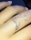 Anaïs Camizuli se fait enlever des tatouages en direct sur Snapchat.