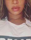 Beyoncé : ses lèvres ont gonflées, aurait-elle fait de la chirurgie esthétique ? Elle réagit à la rumeur !