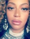 Beyoncé : ses lèvres ont gonflées, aurait-elle fait de la chirurgie esthétique ? Elle réagit à la rumeur !