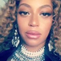 Beyoncé dévoile des lèvres gonflées : a-t-elle fait de la chirurgie esthétique en pleine grossesse ?