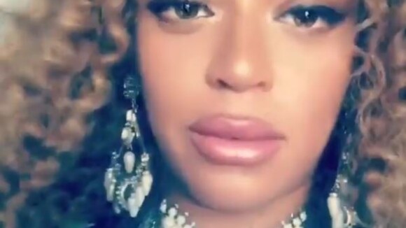Beyoncé dévoile des lèvres gonflées : a-t-elle fait de la chirurgie esthétique en pleine grossesse ?