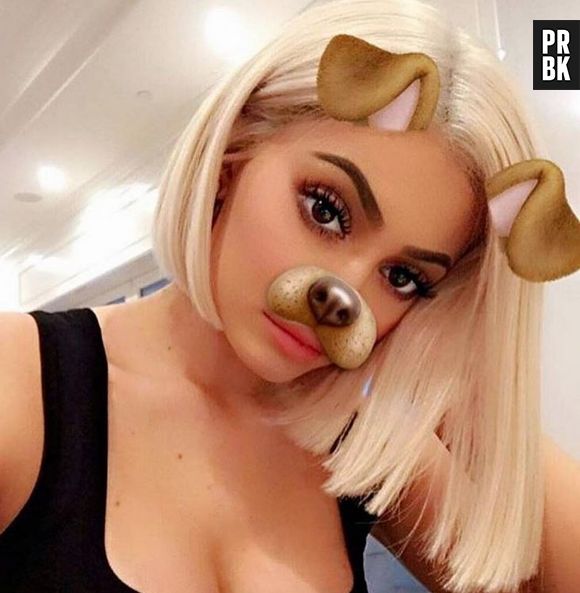 Kylie Jenner sur la chirurgie esthétique : la star avoue enfin pourquoi elle a fait refaire ses lèvres !