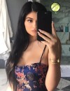 Kylie Jenner sur la chirurgie esthétique : la star avoue enfin pourquoi elle a fait refaire ses lèvres !