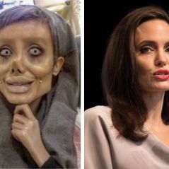 Angelina Jolie : une fan réalise 50 opérations pour lui ressembler et le résultat fait peur 😮