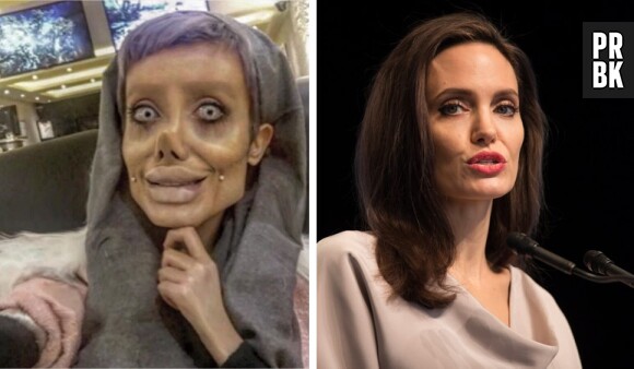 Angeline Jolie : une fan réalise 50 opérations de chirurgie pour lui ressembler