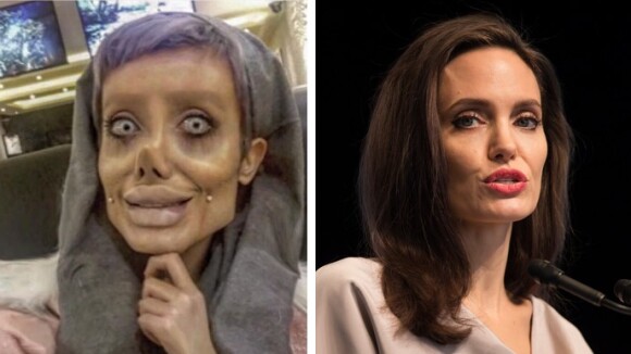 Angelina Jolie : une fan réalise 50 opérations pour lui ressembler et le résultat fait peur ?