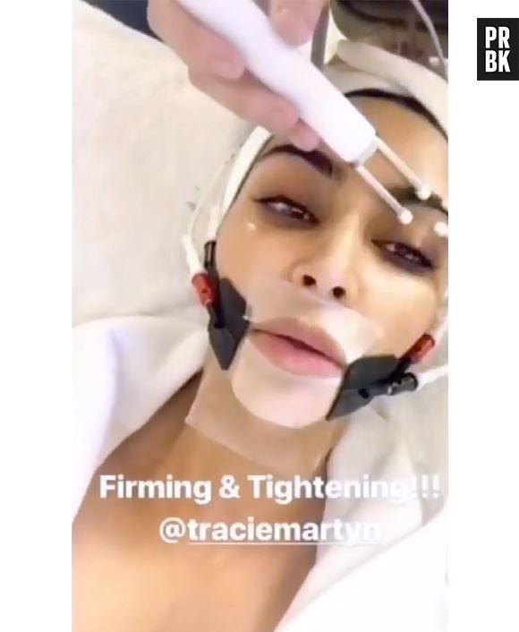 Kim Kardashian : sa nouvelle routine beauté qui fait flipper !
