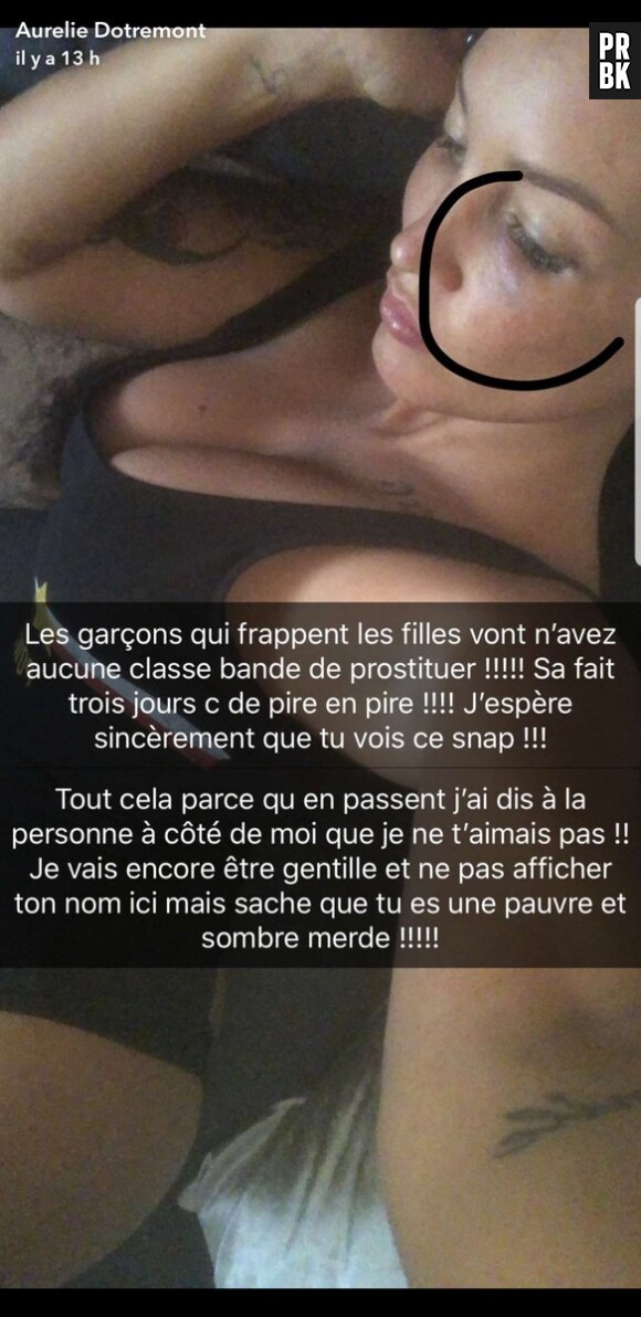 Aurélie Dotremont dévoile son visage tuméfié sur Snapchat