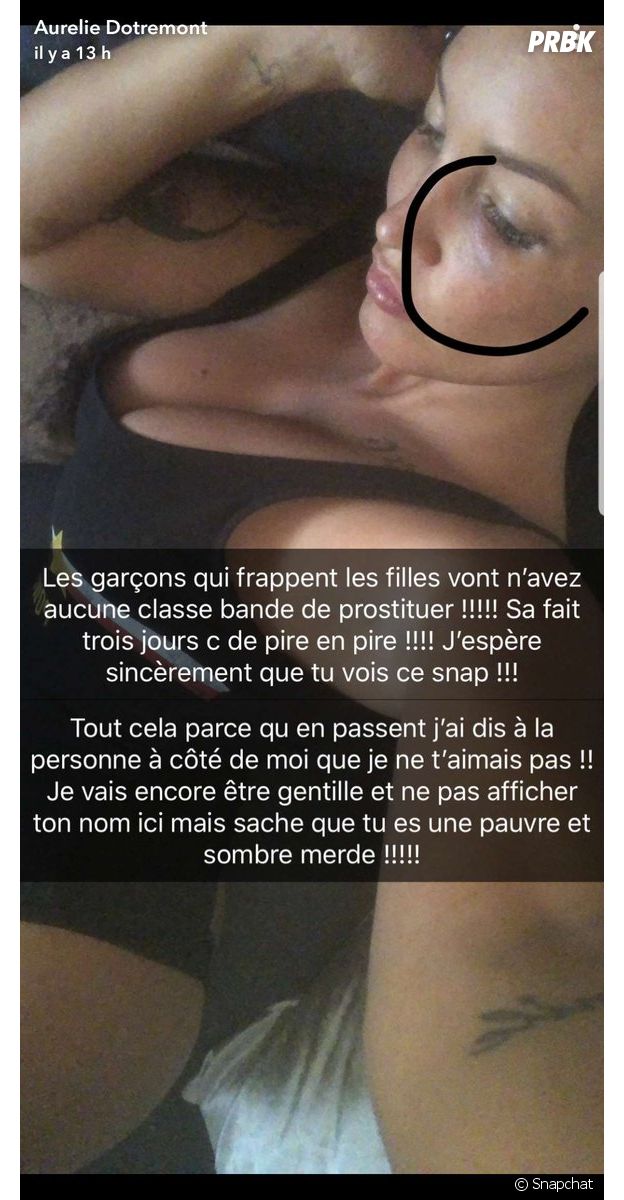 Aurélie Dotremont dévoile son visage tuméfié sur Snapchat