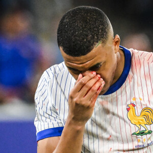 -Kylian Mbappé a été victime d'une fracture du nez lors du match du groupe D de l'Euro 2024 entre l'équipe de France et l'Autriche (1-0) à Dusseldorf en Allemagne le 17 jun 2024. Sorti avec le nez cassé après un choc avec Kevin Danso, Kylian Mbappé a passé des premiers examens qui laissent place à l'optimisme. L'intervention chirurgicale est écartée « dans l'immédiat », selon la FFF.  Kylian Mbappé suffered a broken nose during the Euro 2024 Group D match between France and Austria (1-0) in Dusseldorf, Germany on June 17, 2024. Having left with a broken nose after a collision with Kevin Danso, Kylian Mbappé underwent initial tests that give rise to optimism. Surgery has been ruled out "for the time being," according to the FFF. 