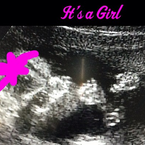 Kevin Jonas : sa femme enceinte d'une Jonas Girl