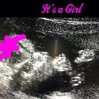 Kevin Jonas : sa femme enceinte d&#039;une Jonas Girl