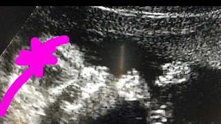 Kevin Jonas : sa femme enceinte d'une Jonas Girl