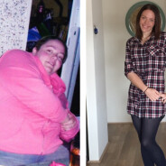 Cette australienne a perdu presque 100 kilos en 4 ans : les séquelles sur son corps sont choquantes