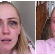 Une blogueuse se filme pour dénoncer les violences de son mari et bouleverse Facebook