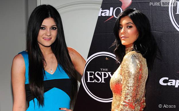 Kylie Jenner : son évolution et sa transformation en Kim Kardashian
