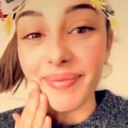 Coralie Porrovecchio : ses lèvres gonflent en direct sur Snapchat