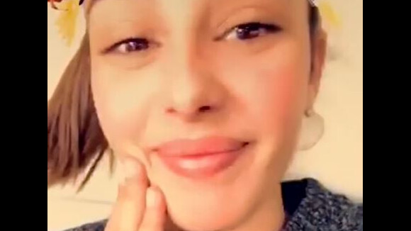Coralie Porrovecchio : ses lèvres gonflent en direct sur Snapchat