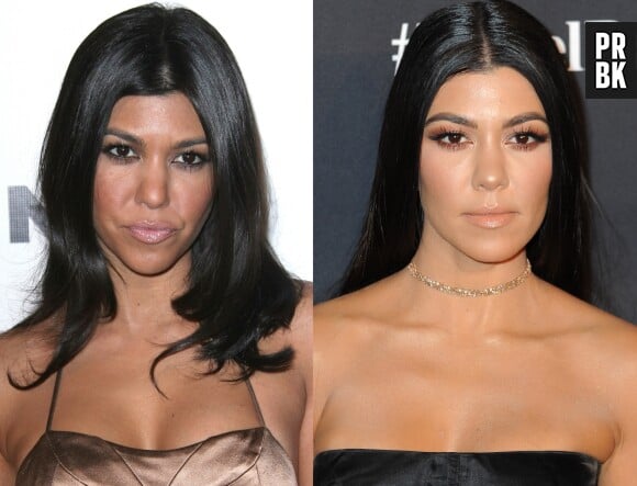Kourtney Kardashian avant-après la chirurgie esthétique !
