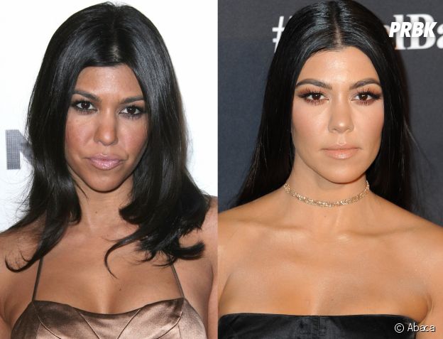 Kourtney Kardashian avant-après la chirurgie esthétique !