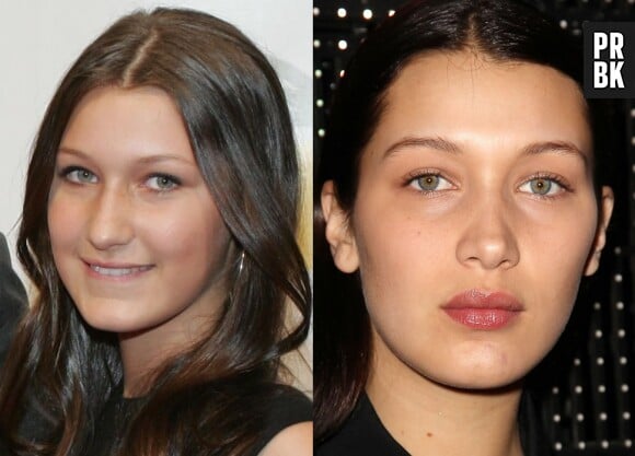 Bella Hadid avant-après : transformée, la soeur de Gigi Hadid est accusée d'avoir eu recours à la chirurgie esthétique.
