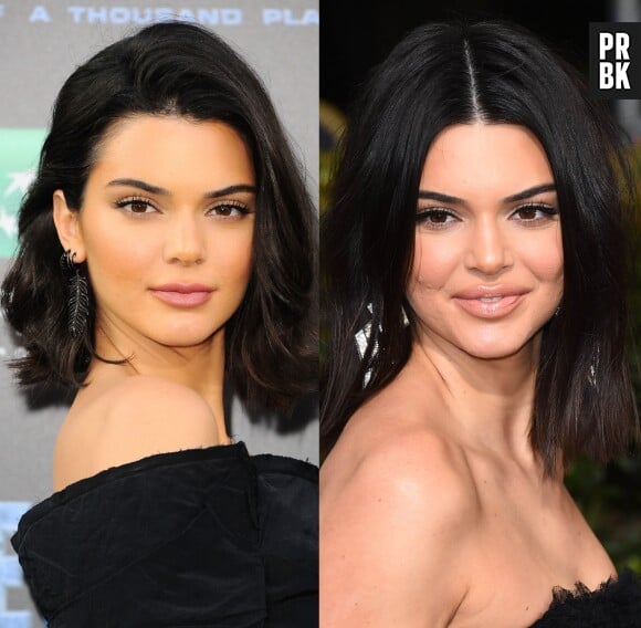 Kendall Jenner a-t-elle eu recours à la chirurgie esthétique ? Ses lèvres ont grossi, les internautes la clashent !