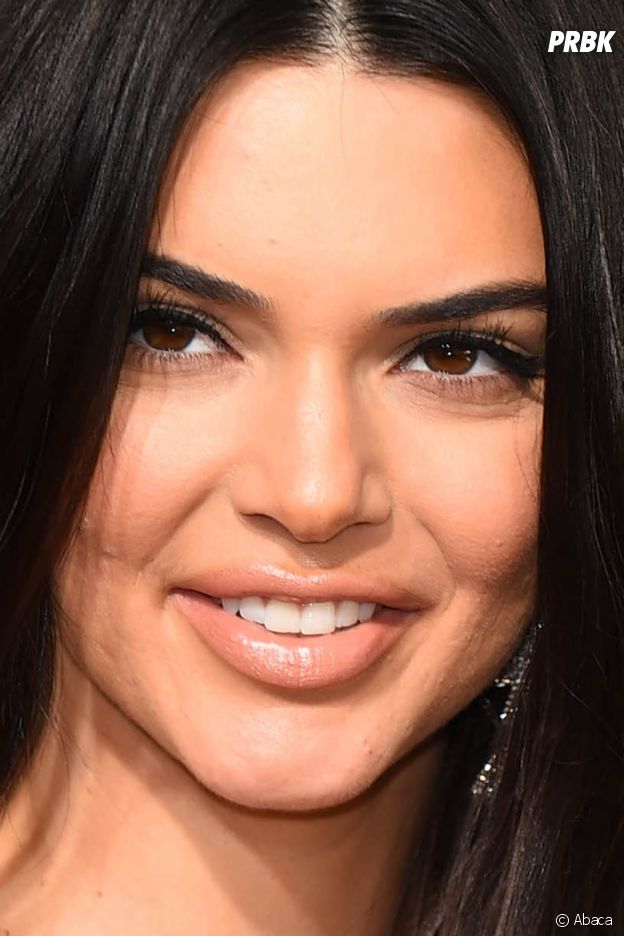 Kendall Jenner assume maintenant son acné !