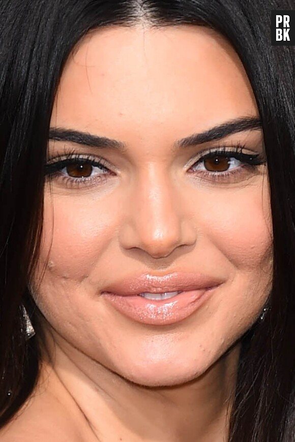 Kendall Jenner assume maintenant son acné !