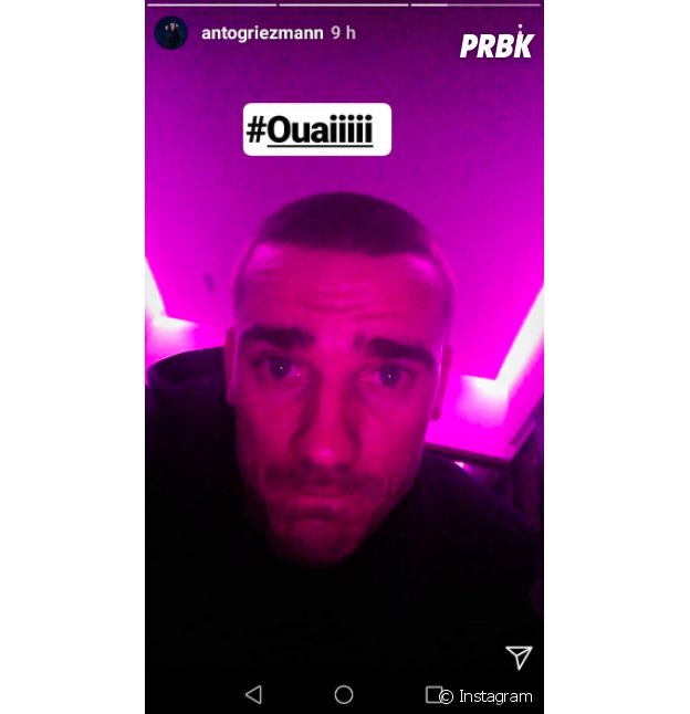 Antoine Griezmann : finies les coupes de cheveux improbables ? Il s'est rasé les cheveux !