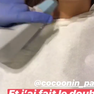 Emma CakeCup partage ses dernières opérations de chirurgie esthétique sur Instagram