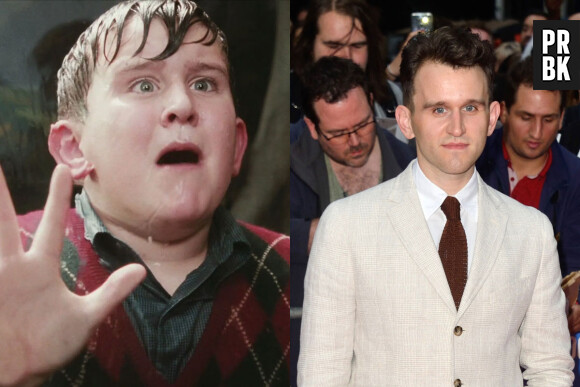 Harry Melling dans le premier film Harry Potter VS aujourd'hui