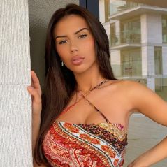 Dita Istrefi (Les Princes) agressée et défigurée : elle se montre après l'opération au visage